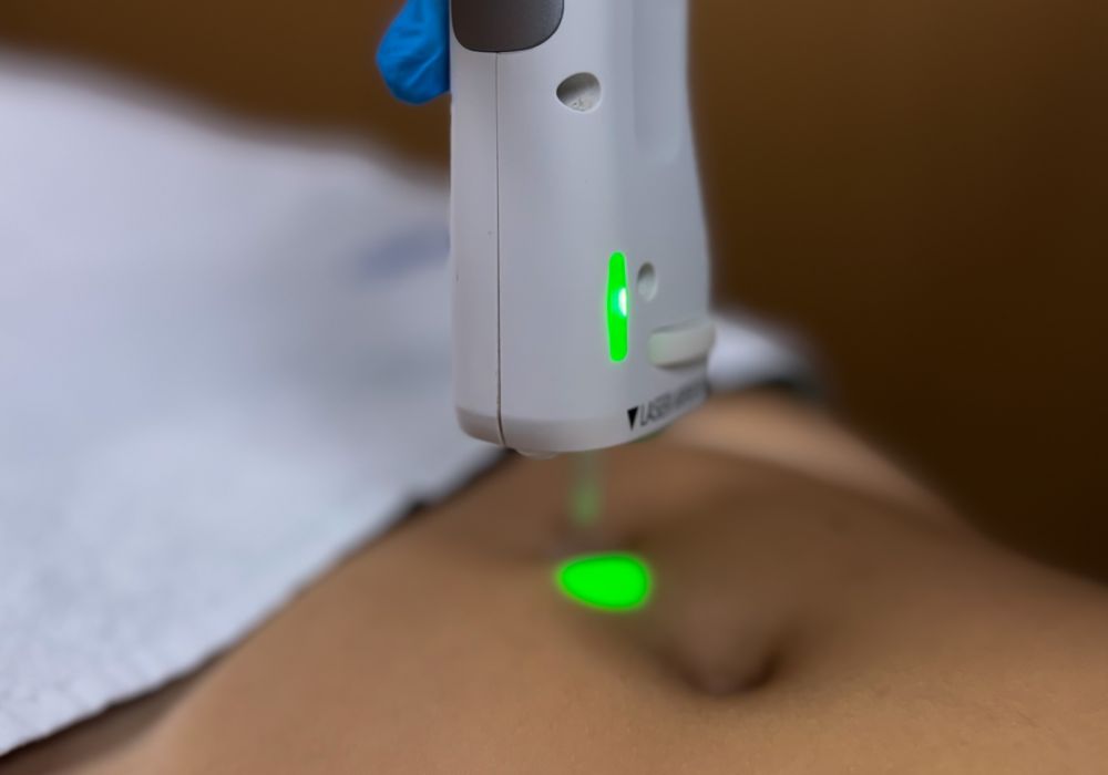 Ligne ombilicale (Pack 8 séances)