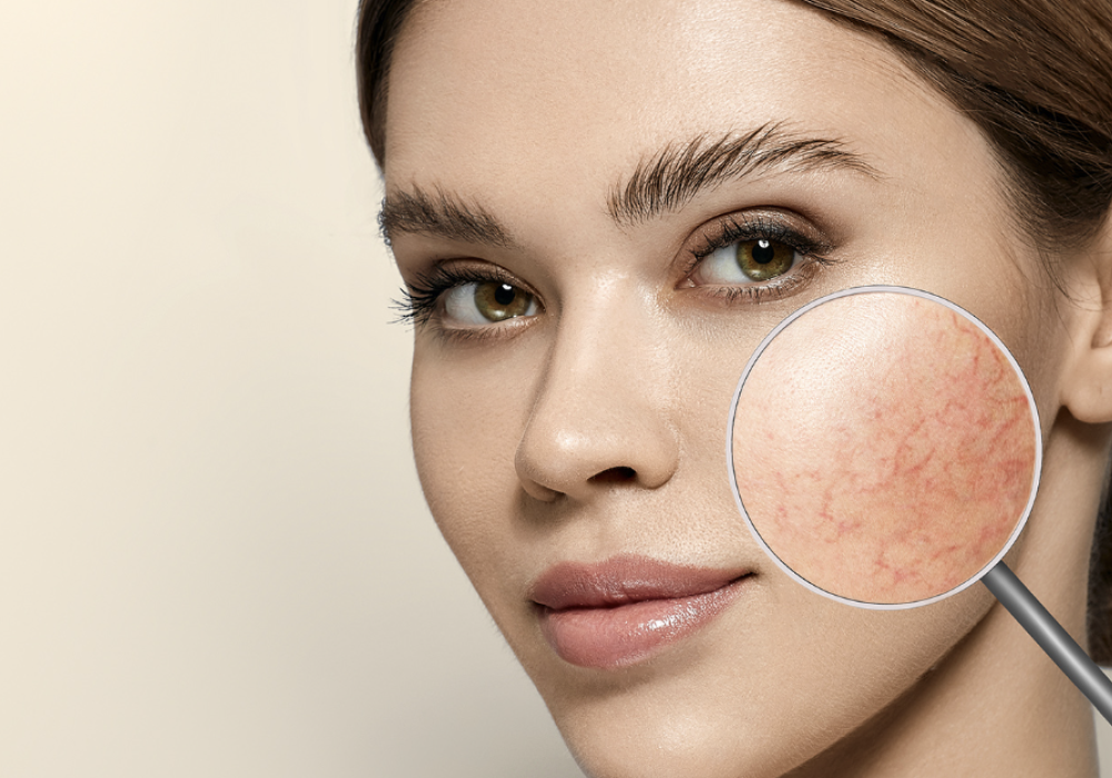 Drainage lymphatique – Soin (avec visage)