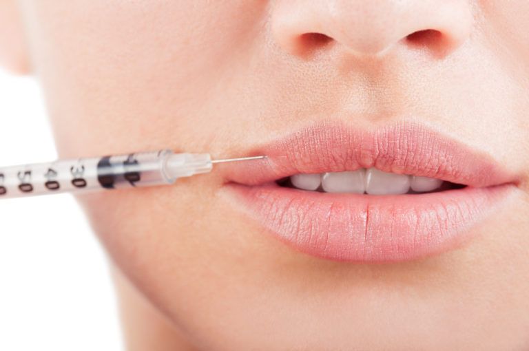Injections lèvres