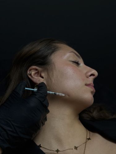 Mésothérapie (Mésolift)