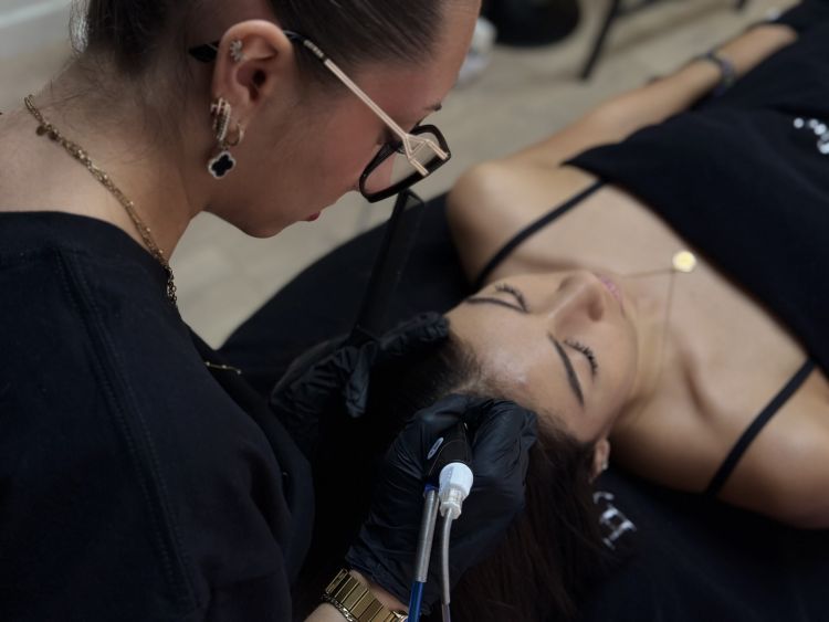 Chute de cheveux et alopécie