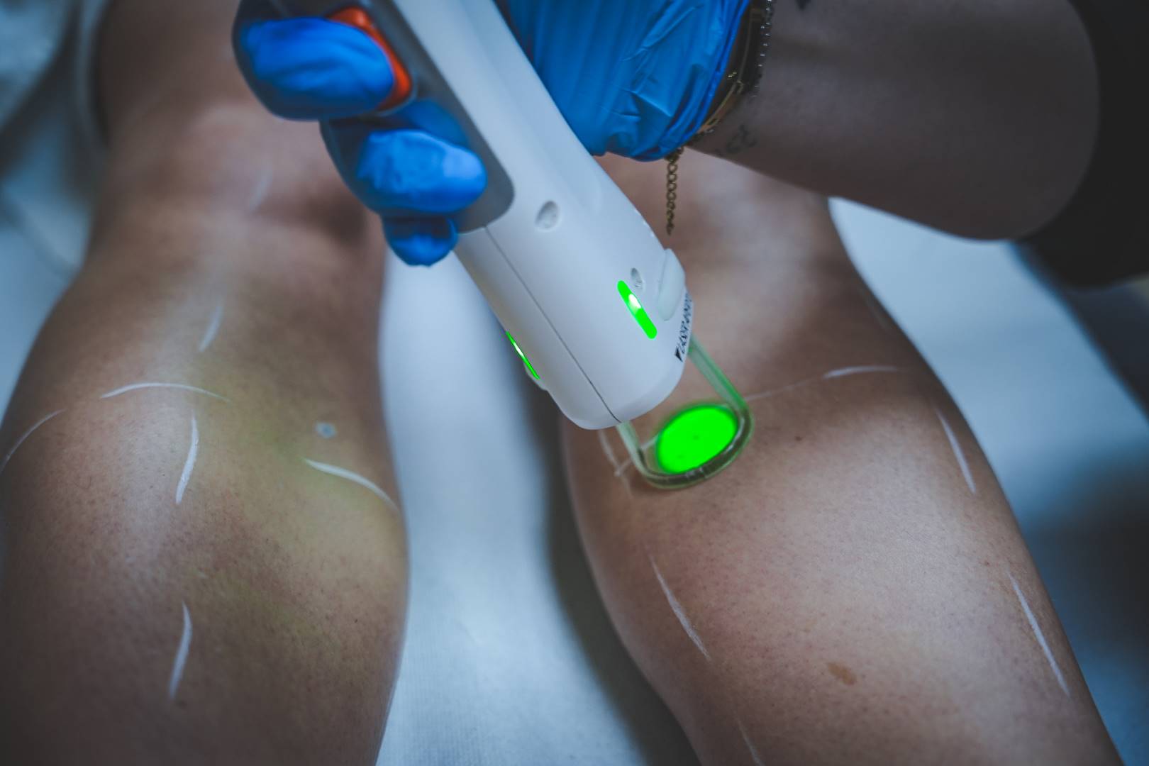 &Eacute;pilation &eacute;lectrique