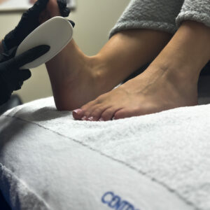 Calluspeeling + limage