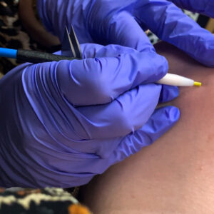 Épilation électrique (Pack 300 min)