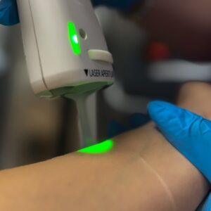 Avants bras (Pack 8 séances)