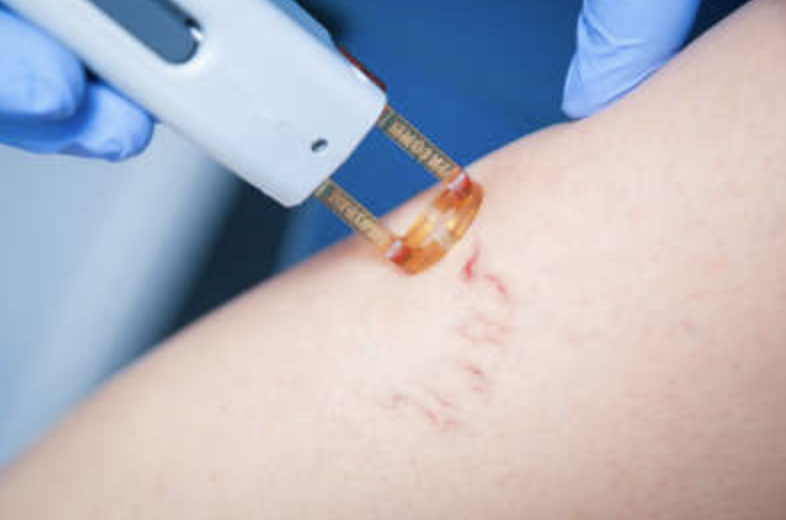 Injections et comblements