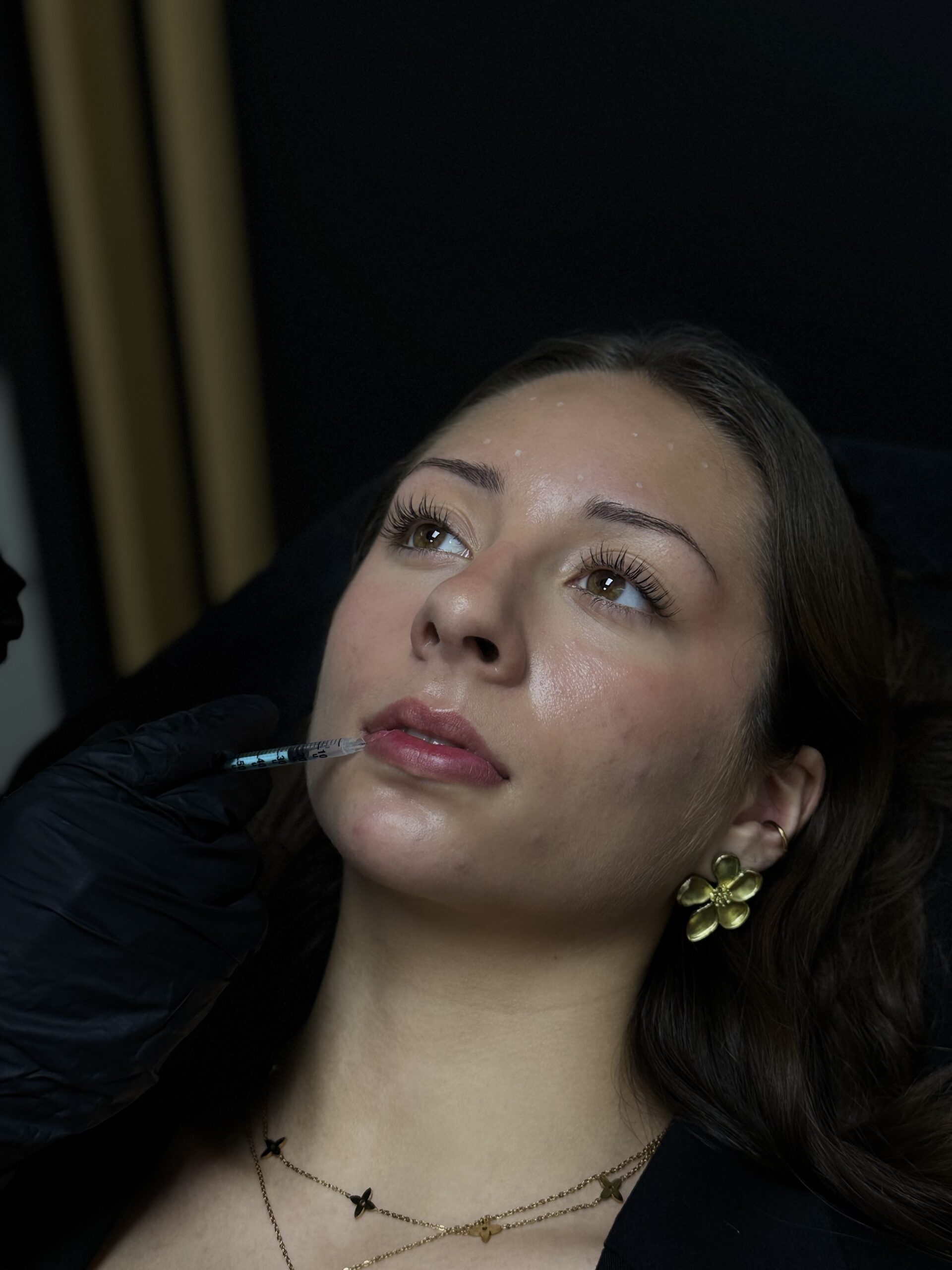 L&egrave;vres fines, asym&eacute;triques ou marqu&eacute;es par des rides