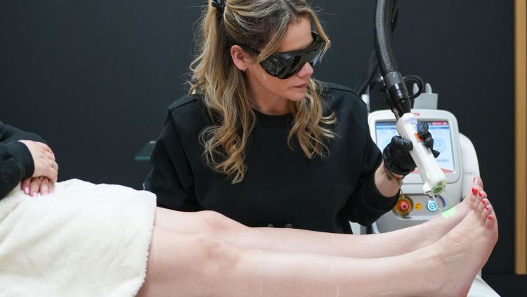 epilation laser