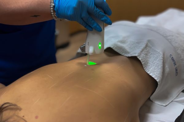 Épilation laser – Dos complet (séance)