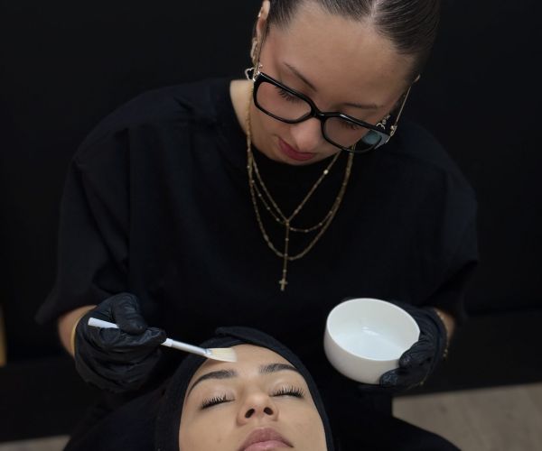 Hyperpigmentation : tâches brunes, mélasma