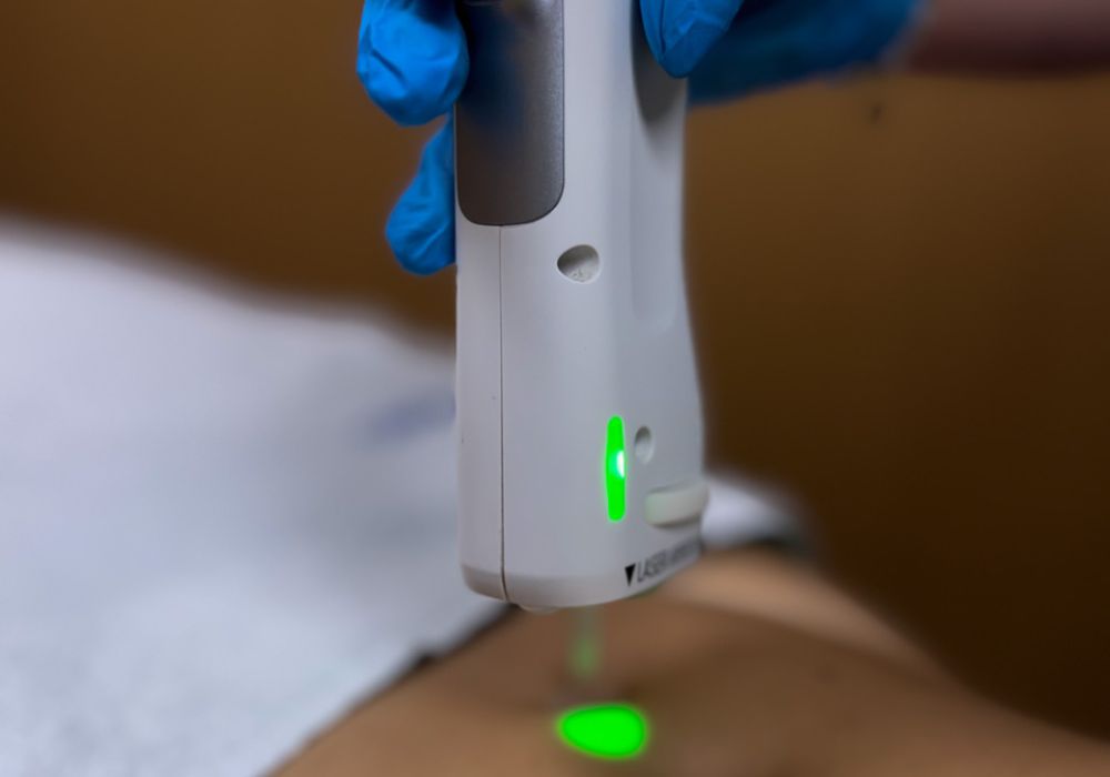 Épilation laser – Buste (séance)