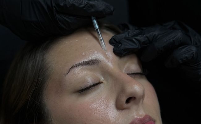 Rides d&rsquo;expression et plis marqu&eacute;s