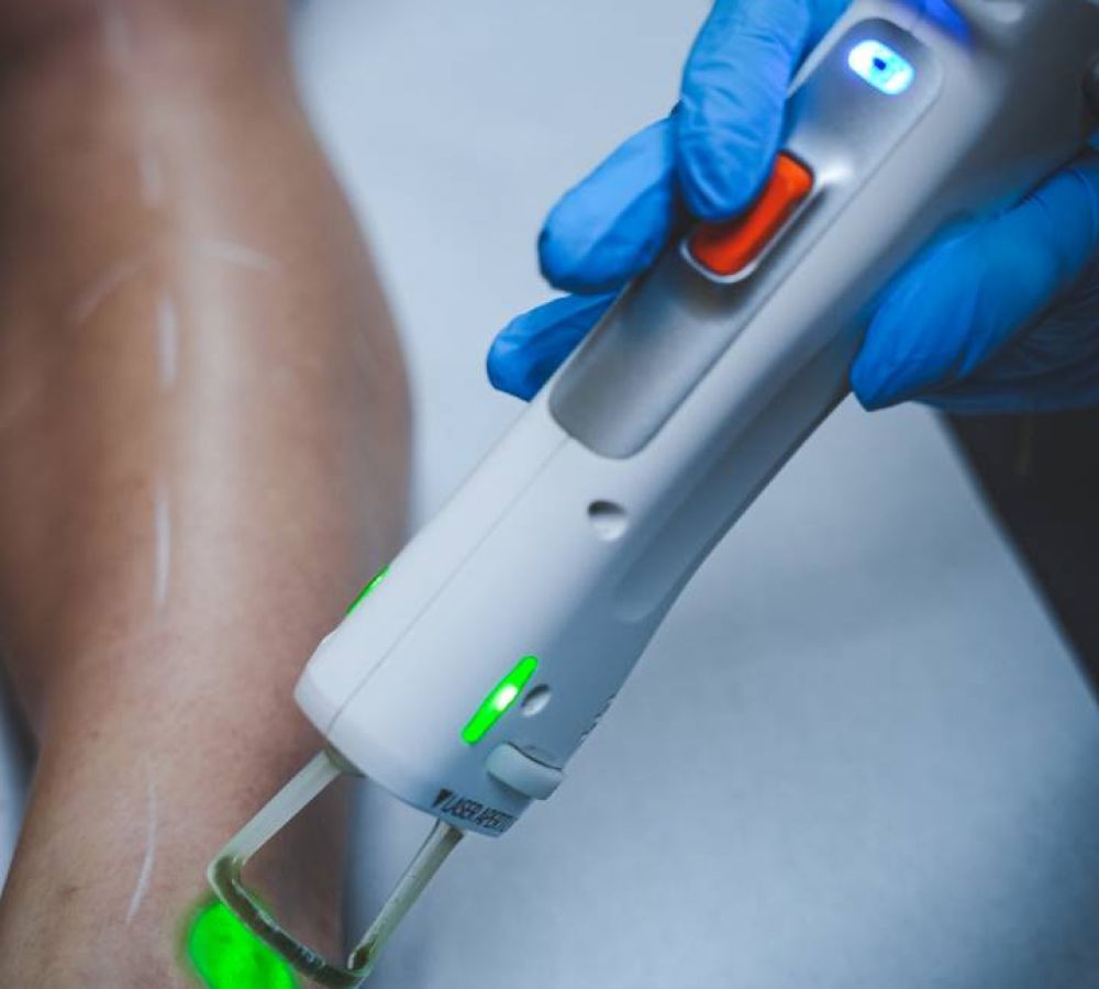 Op&eacute;ration laser