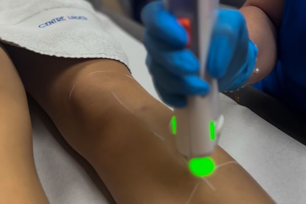 Épilation laser – Aisselles + Maillot échancré + Demi-jambes (séance)