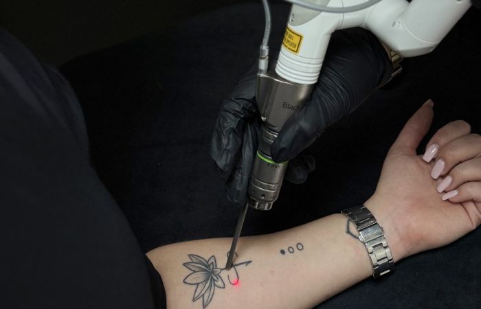 détatouage