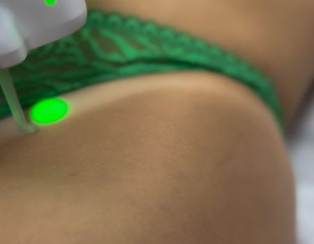 Épilation laser – Maillot intégral (séance)