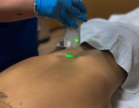 Épilation laser – Dos complet (séance)