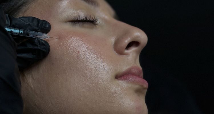 Injections de toxine botulique (Botox)&nbsp;