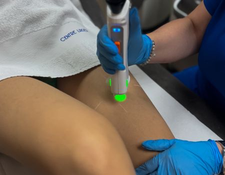 Épilation laser – Jambes complètes (séance)