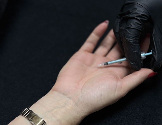 Transpiration excessive (hyperhidrose)