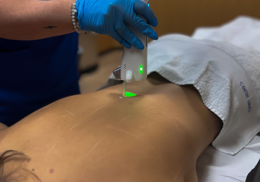 Épilation laser – Genoux (séance)