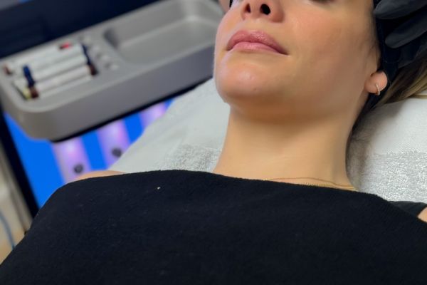 HydraFacial – Deluxe