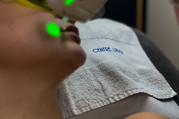 Épilation laser – Cou (séance)
