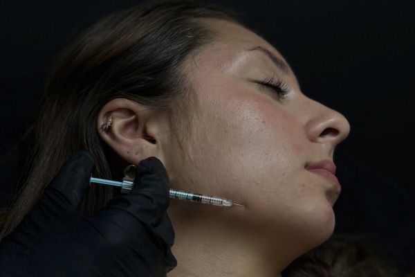 M&acirc;choire trop marqu&eacute;e ou disproportionn&eacute;e