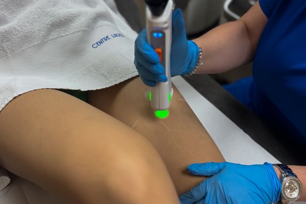 Épilation laser – Aisselles + Maillot échancré + Jambes complètes (séance)