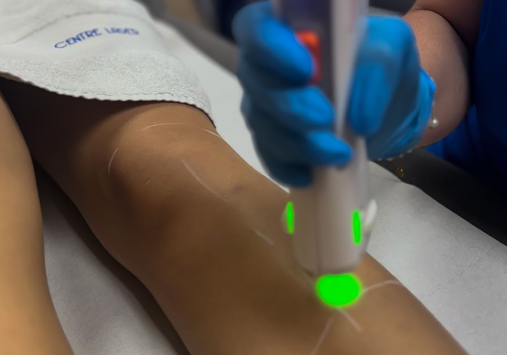 Épilation laser – Aisselles + Maillot échancré + Demi-jambes (séance)