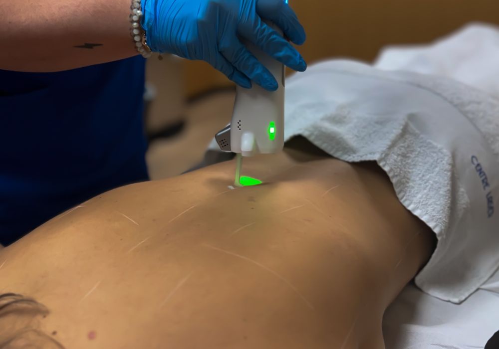 Épilation laser – Dos complet (séance)