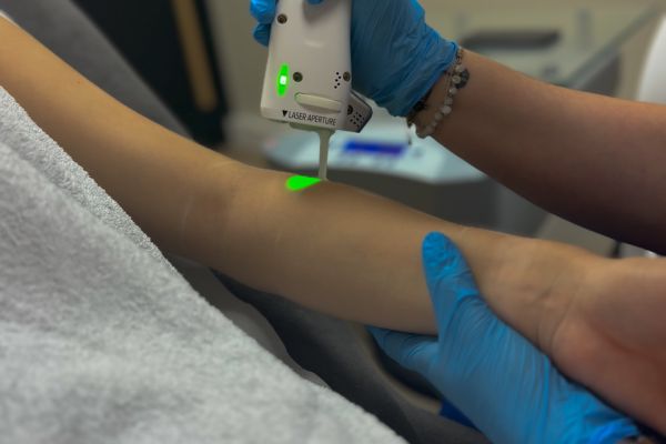 Épilation laser – Bras complets (séance)