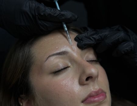 Microneedling – Séance